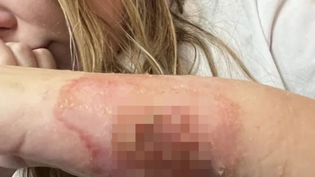 11yr-old-hospitalised-after-using-manicure-set