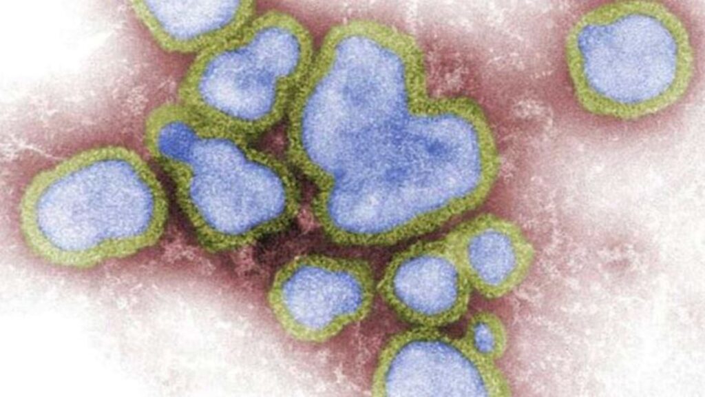 aussie-child-tests-positive-to-bird-flu