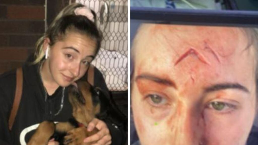 woman-brutally-mauled-by-dog-she-knew-since-a-puppy