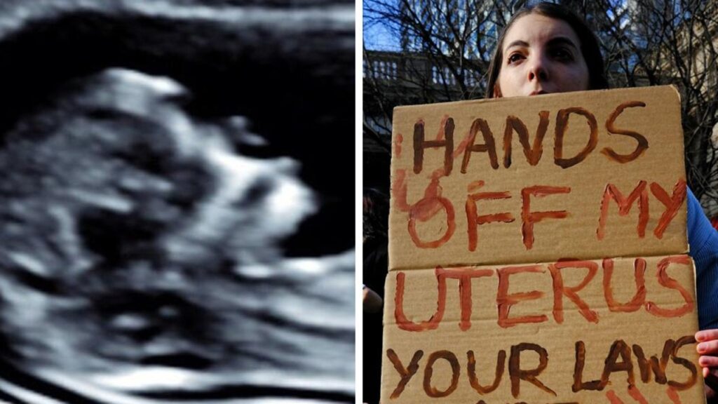 warning-over-‘dangerous’-abortion-debate