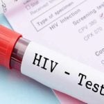 Ρόδος HIV